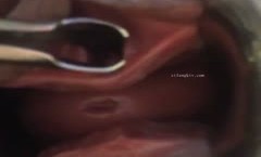字母圈网红SM界天花板重度性虐大师Imur各种极限调教私拍扩张 异物 虐阴虐尿道花样繁多(31)